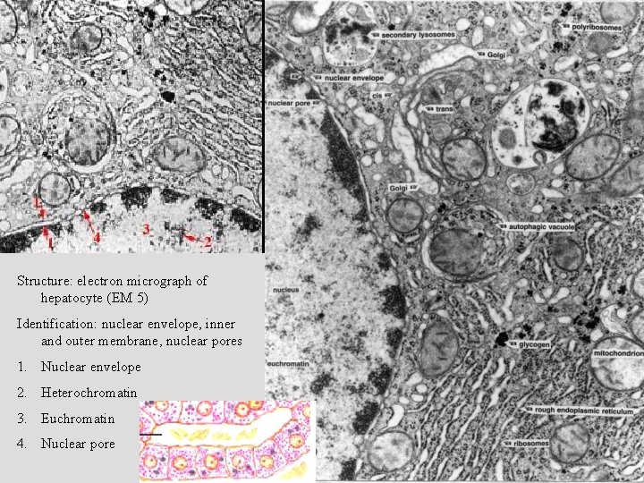 Structure: electron micrograph of hepatocyte (EM 5) Identification: nuclear envelope, inner and outer membrane,