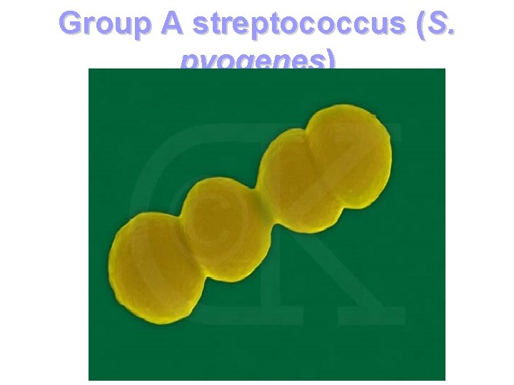 Group A streptococcus (S. pyogenes) 