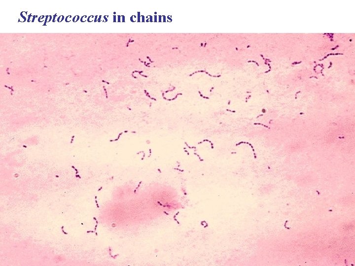 Streptococcus in chains 
