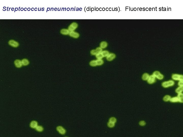 Streptococcus pneumoniae (diplococcus). Fluorescent stain 