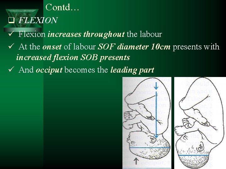 Contd… q FLEXION ü Flexion increases throughout the labour ü At the onset of