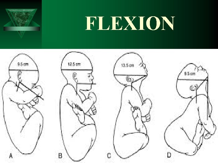 FLEXION 