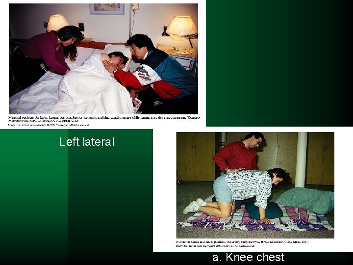 Left lateral a. Knee chest 