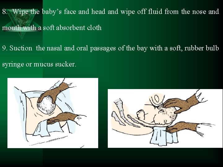 8. Wipe the baby’s face and head and wipe off fluid from the nose
