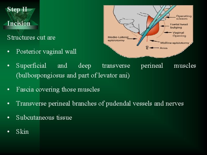Step II Incision Structures cut are • Posterior vaginal wall • Superficial and deep