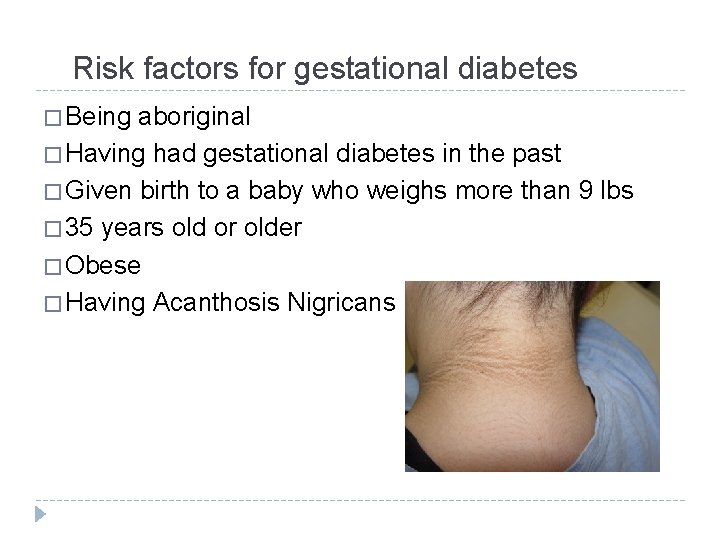 Risk factors for gestational diabetes � Being aboriginal � Having had gestational diabetes in