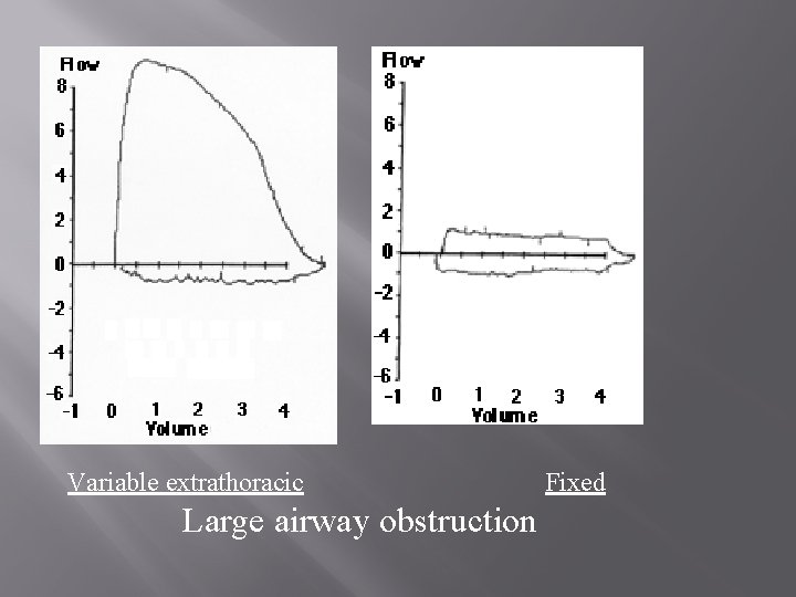 Variable extrathoracic Large airway obstruction Fixed 