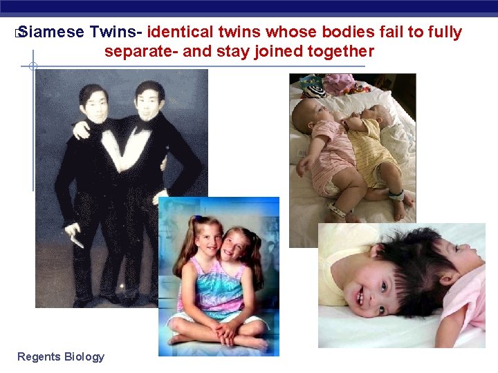 � Siamese Twins- identical twins whose bodies fail to fully separate- and stay joined