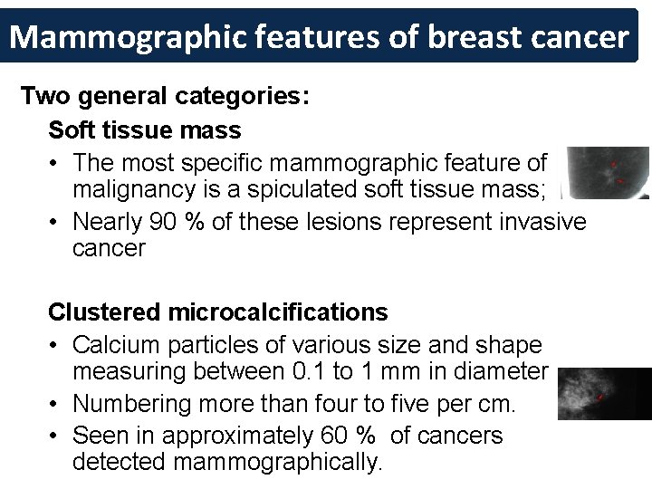 Mammographic features of breast cancer Two general categories: Soft tissue mass • The most