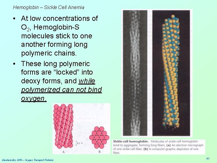 Hemoglobin – Sickle Cell Anemia • At low concentrations of O 2, Hemoglobin-S molecules