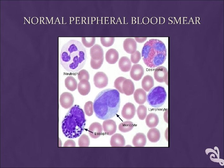 NORMAL PERIPHERAL BLOOD SMEAR 