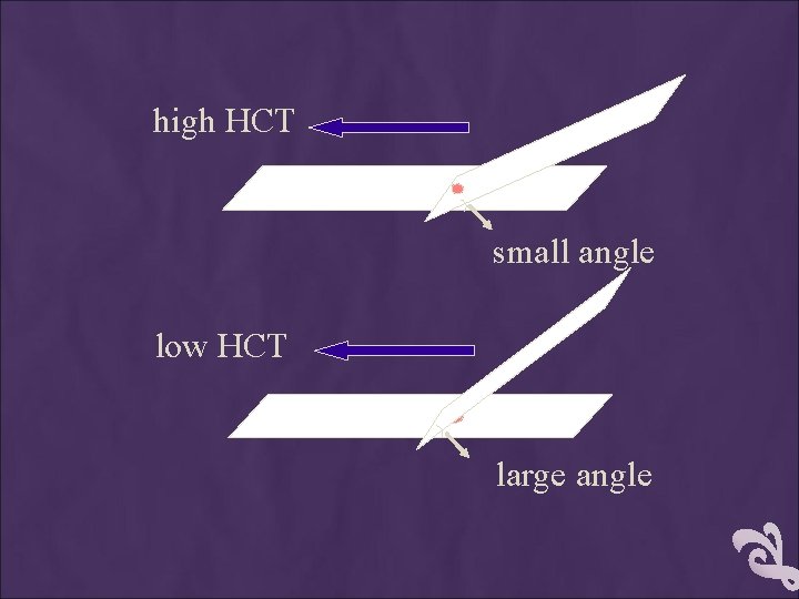high HCT small angle low HCT large angle 