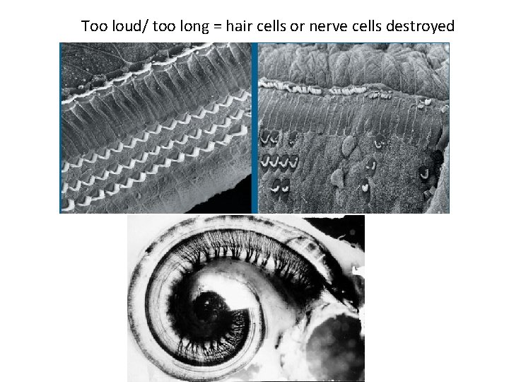 Too loud/ too long = hair cells or nerve cells destroyed 