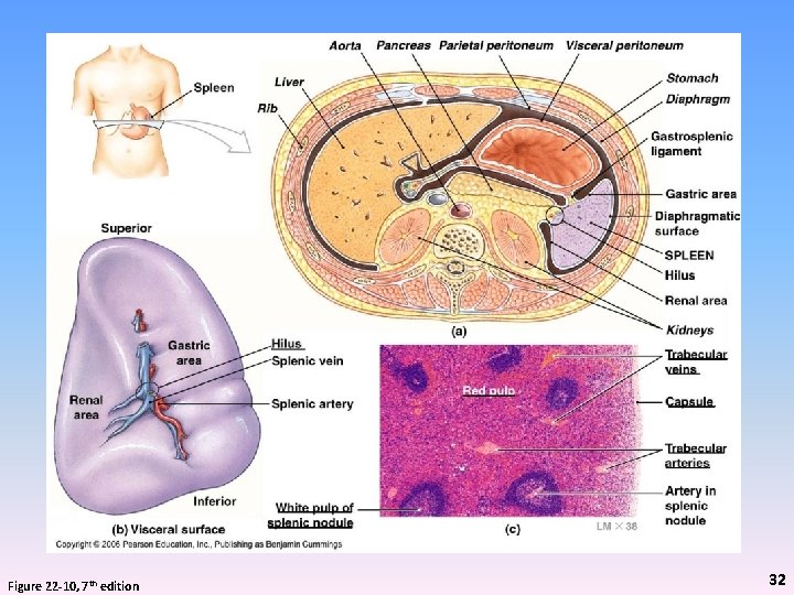 Figure 22 -10, 7 th edition 32 