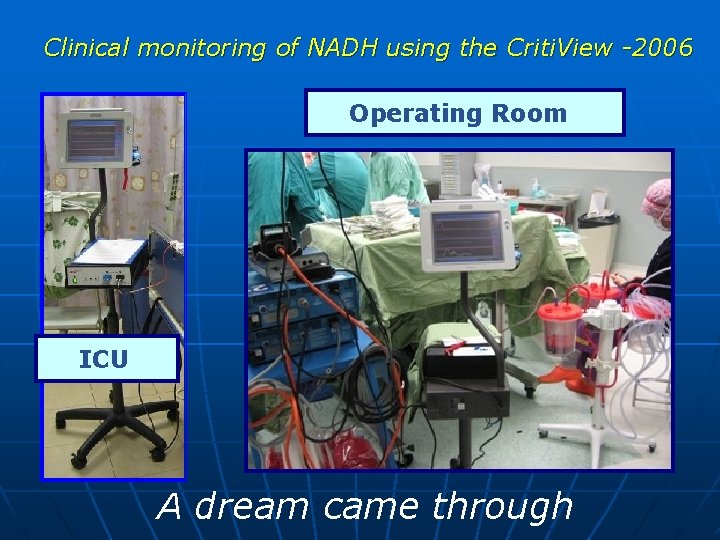 Clinical monitoring of NADH using the Criti. View -2006 Operating Room ICU A dream