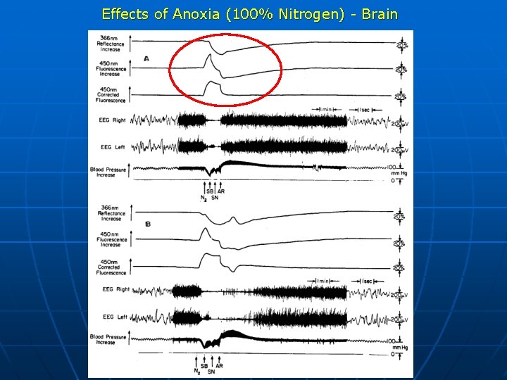 Effects of Anoxia (100% Nitrogen) - Brain 