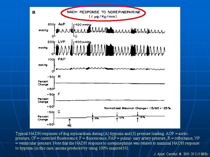 Typical NADH responses of dog myocardium during (A) hypoxia and (8) pressure loading. AOP