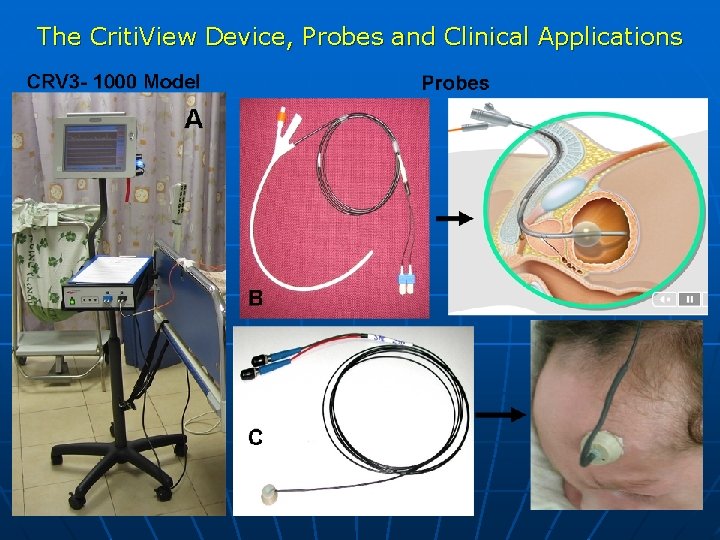 The Criti. View Device, Probes and Clinical Applications 