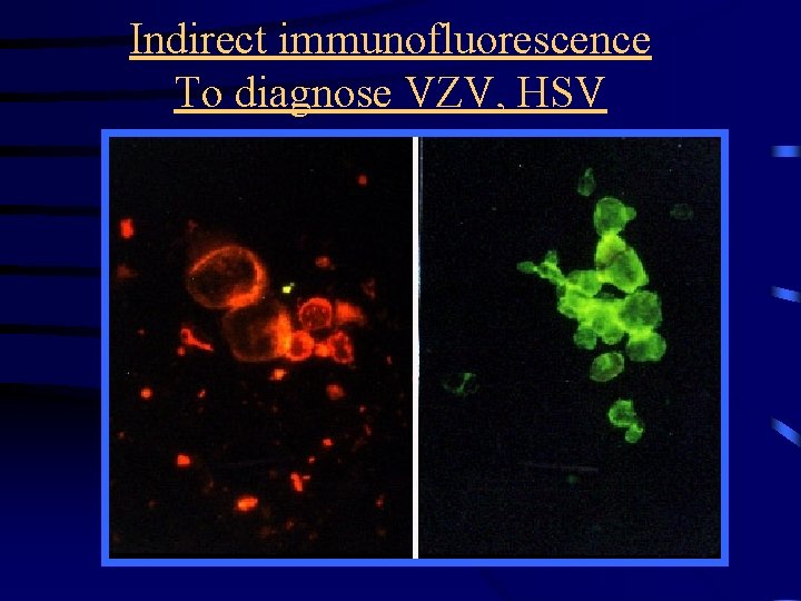 Indirect immunofluorescence To diagnose VZV, HSV 
