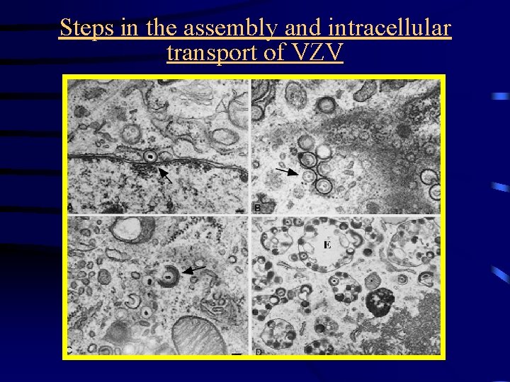 Steps in the assembly and intracellular transport of VZV 