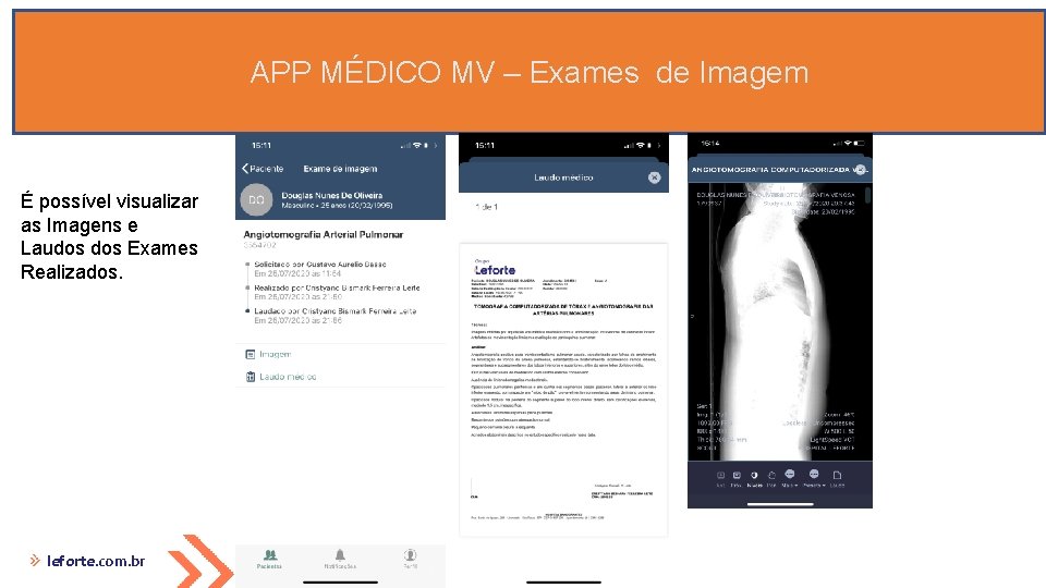 APP MÉDICO MV – Exames de Imagem É possível visualizar as Imagens e Laudos