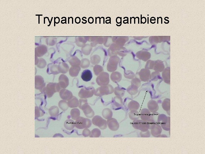 Trypanosoma gambiens Trypanosoma gambiens
