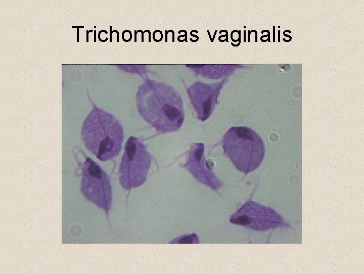 Trichomonas vaginalis Trichomonas vaginalis