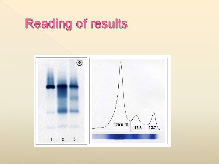 Reading of results 