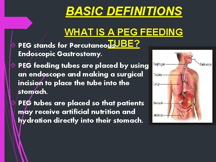 BASIC DEFINITIONS WHAT IS A PEG FEEDING TUBE? PEG stands for Percutaneous Endoscopic Gastrostomy.