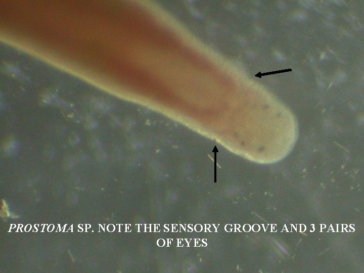 PROSTOMA SP. NOTE THE SENSORY GROOVE AND 3 PAIRS OF EYES 