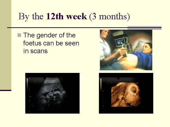 By the 12 th week (3 months) n The gender of the foetus can