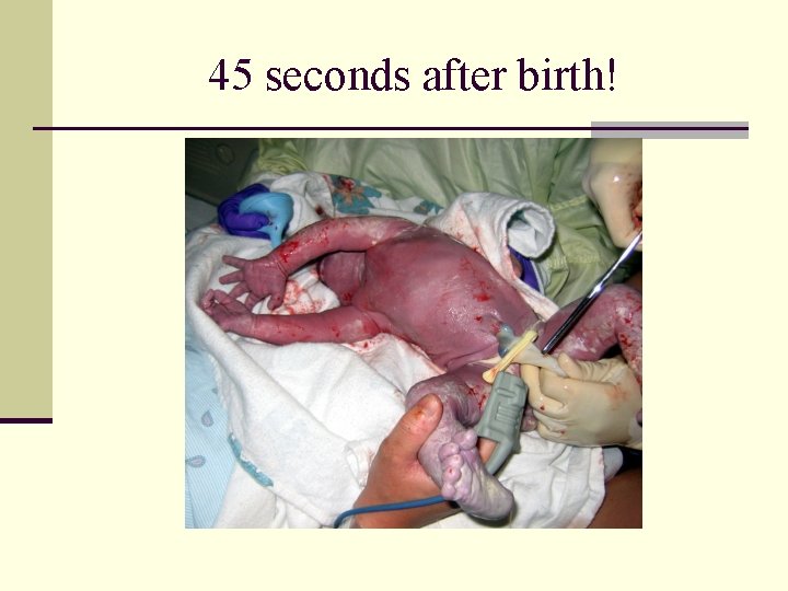 45 seconds after birth! 