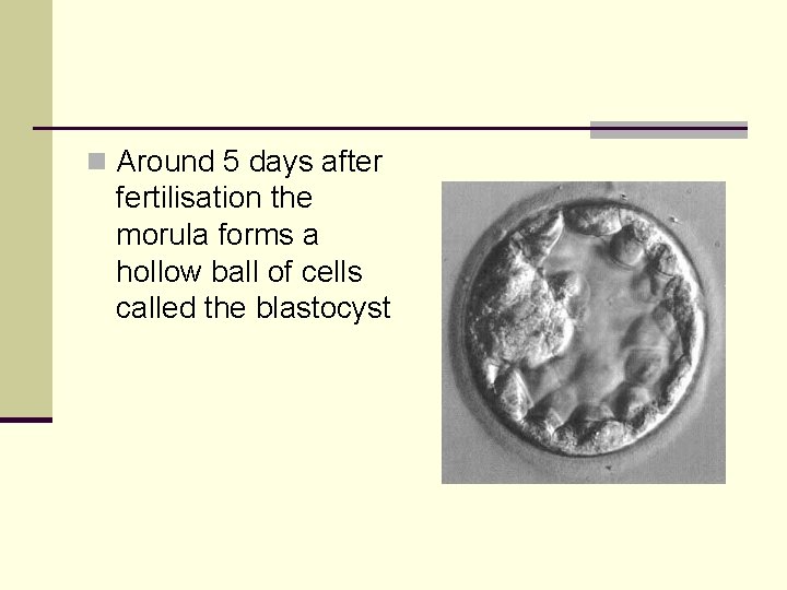 n Around 5 days after fertilisation the morula forms a hollow ball of cells