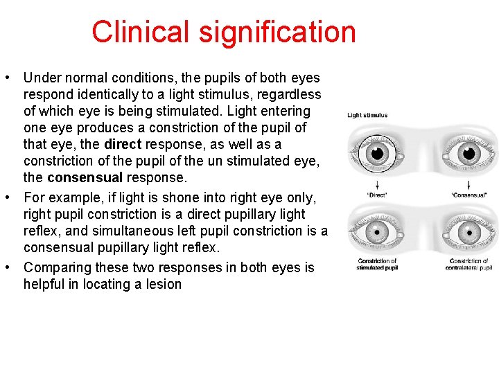 Clinical signification • Under normal conditions, the pupils of both eyes respond identically to