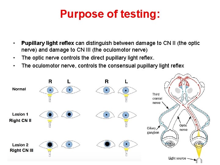 Purpose of testing: • • • Pupillary light reflex can distinguish between damage to
