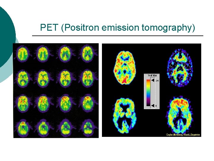 PET (Positron emission tomography) 