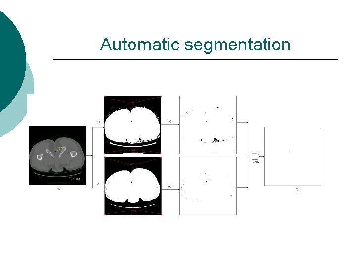 Automatic segmentation 