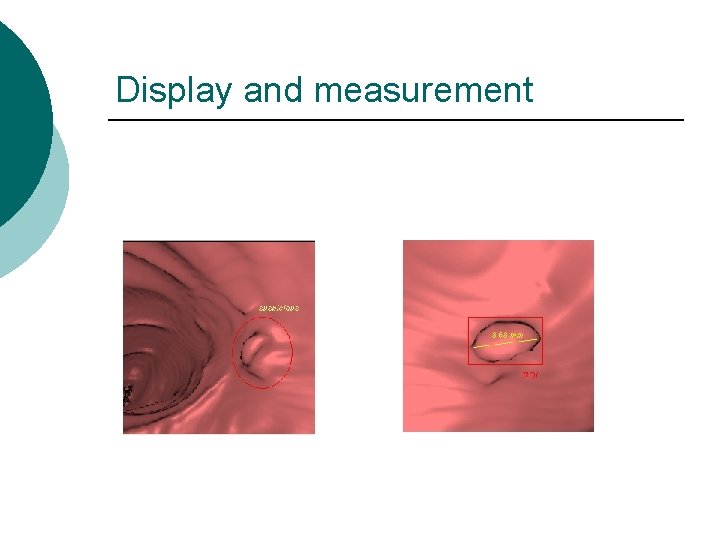 Display and measurement 