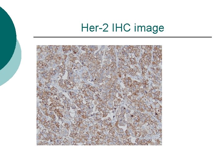 Her-2 IHC image 