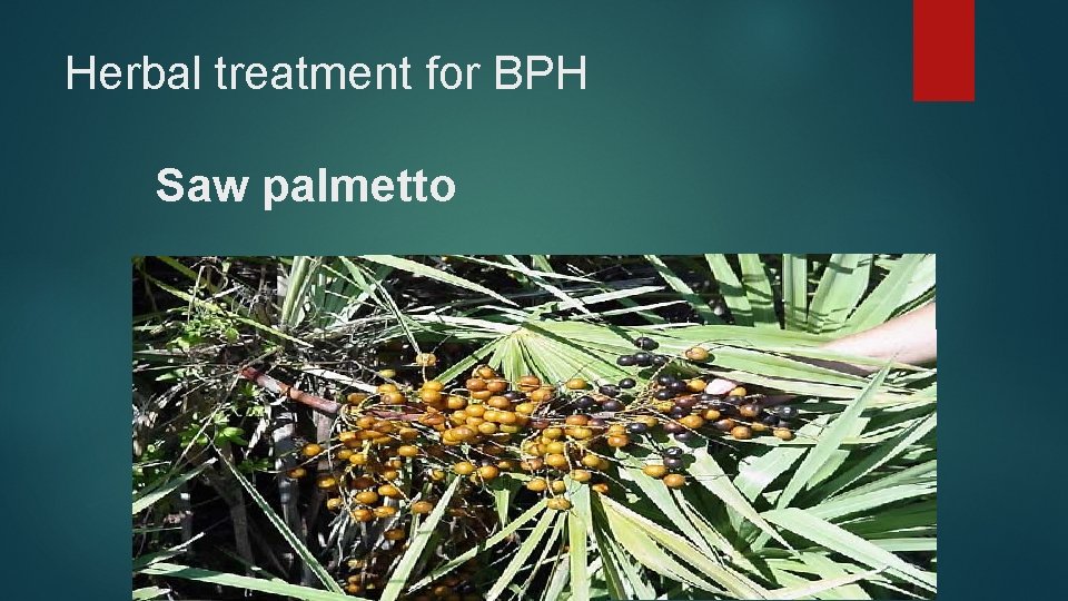 Herbal treatment for BPH Saw palmetto 