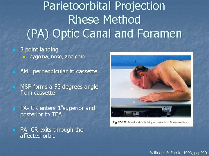 Parietoorbital Projection Rhese Method (PA) Optic Canal and Foramen n 3 point landing n