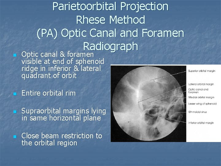 n Parietoorbital Projection Rhese Method (PA) Optic Canal and Foramen Radiograph Optic canal &
