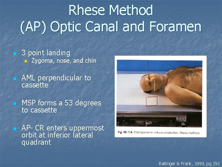 Rhese Method (AP) Optic Canal and Foramen n 3 point landing n Zygoma, nose,