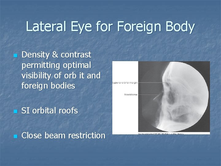 Lateral Eye for Foreign Body n Density & contrast permitting optimal visibility of orb