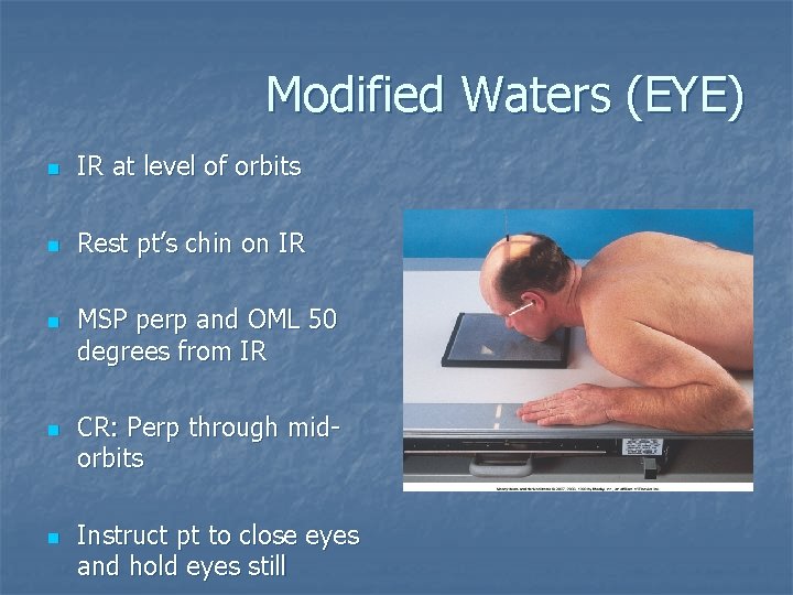 Modified Waters (EYE) n IR at level of orbits n Rest pt’s chin on