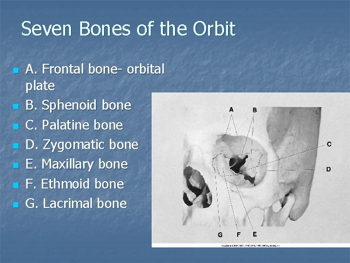 Seven Bones of the Orbit n n n n A. Frontal bone- orbital plate