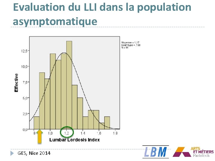 Evaluation du LLI dans la population asymptomatique GES, Nice 2014 