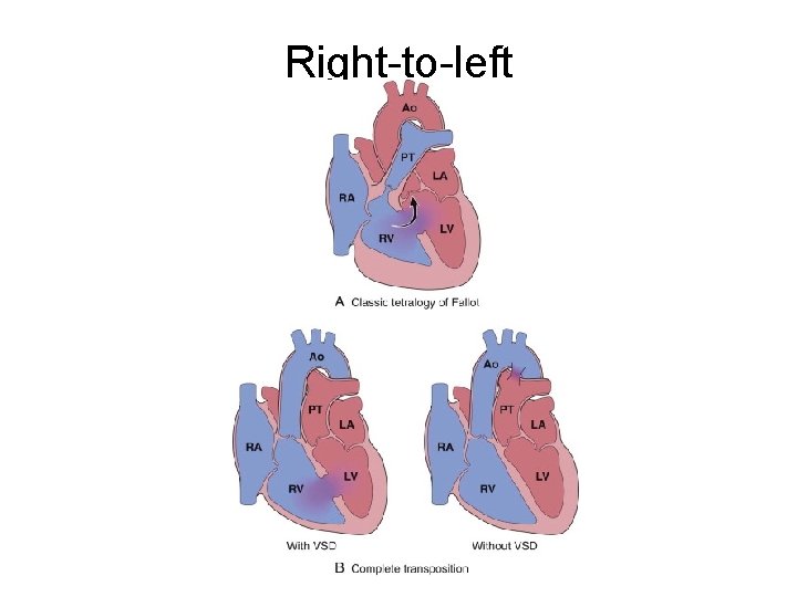 Right-to-left 