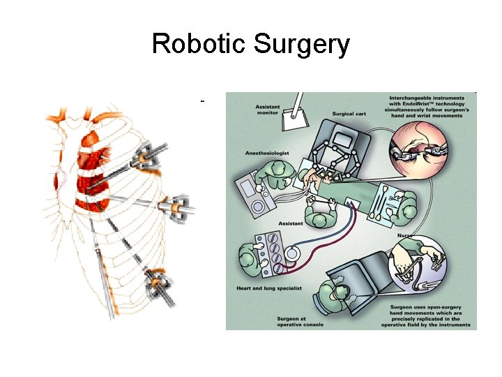 Robotic Surgery 