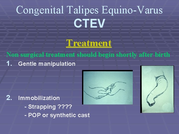 Congenital Talipes Equino-Varus CTEV Treatment Non surgical treatment should begin shortly after birth 1.